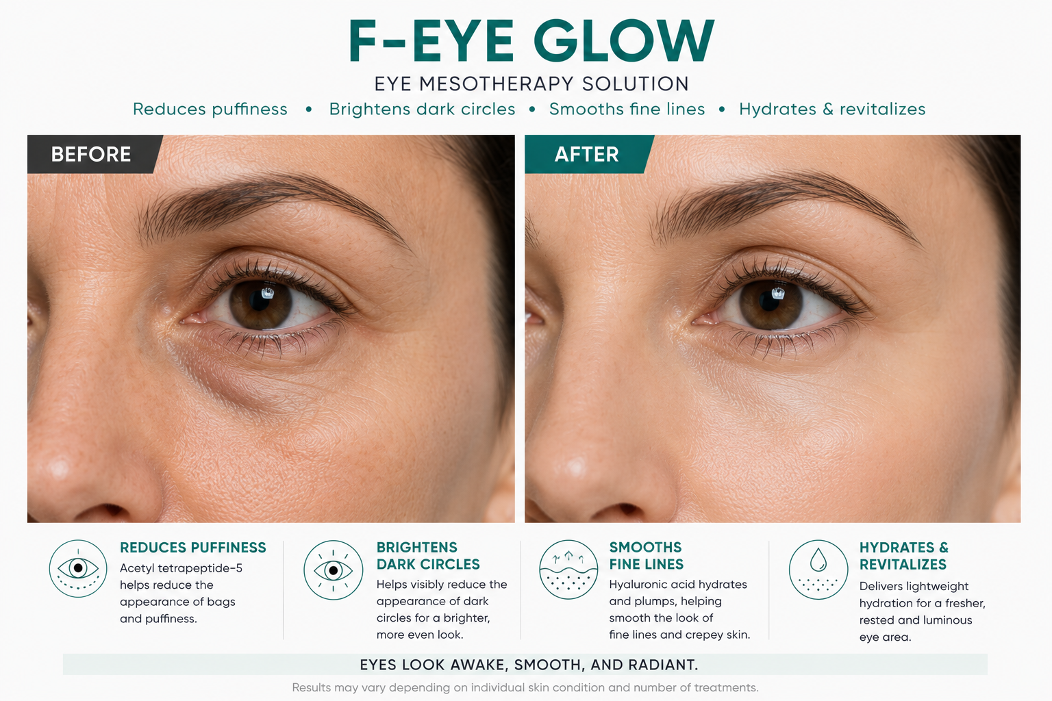 F-EYE GLOW Eye Contour Brightening Solution 5 vials x 3 ml (0.5 fl. oz.)