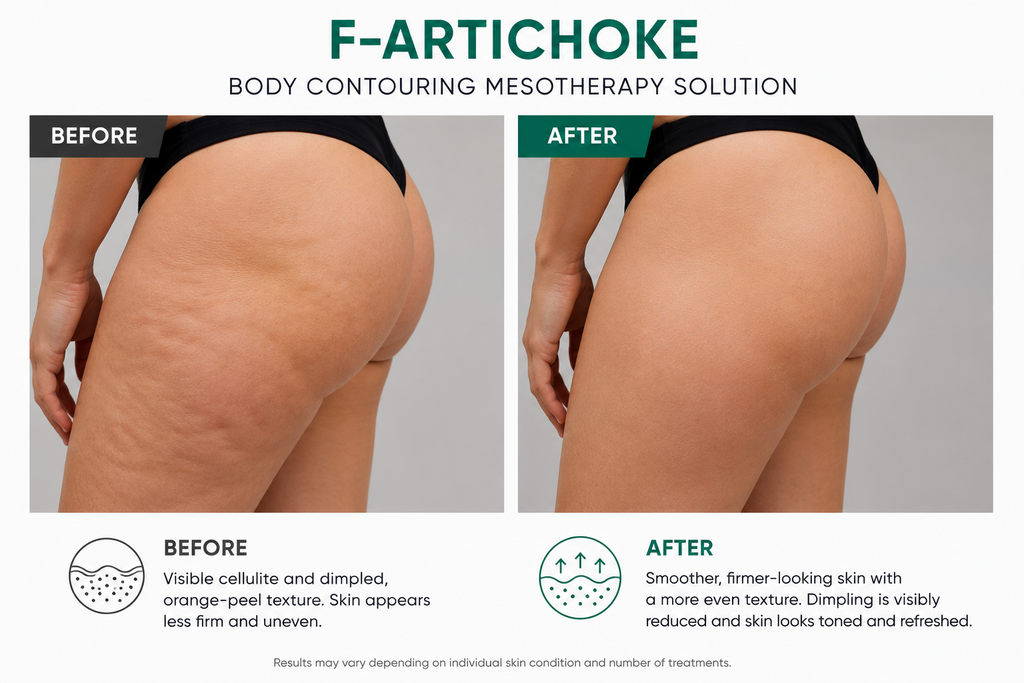 F-ARTICHOKE Artichoke Extract Body Contour Solution 5 vials x 10 ml (1.69 fl. oz)