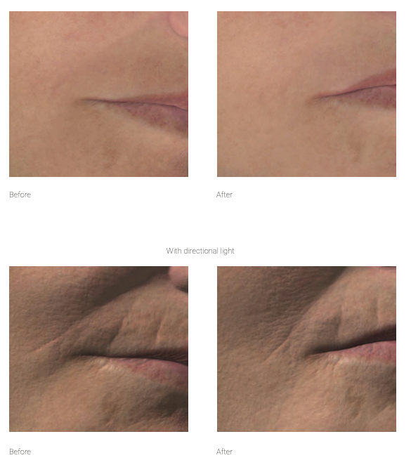 F-LIFT+ FACE Lifting & Firming Ampoule 5 × 5 ml (25 ml)