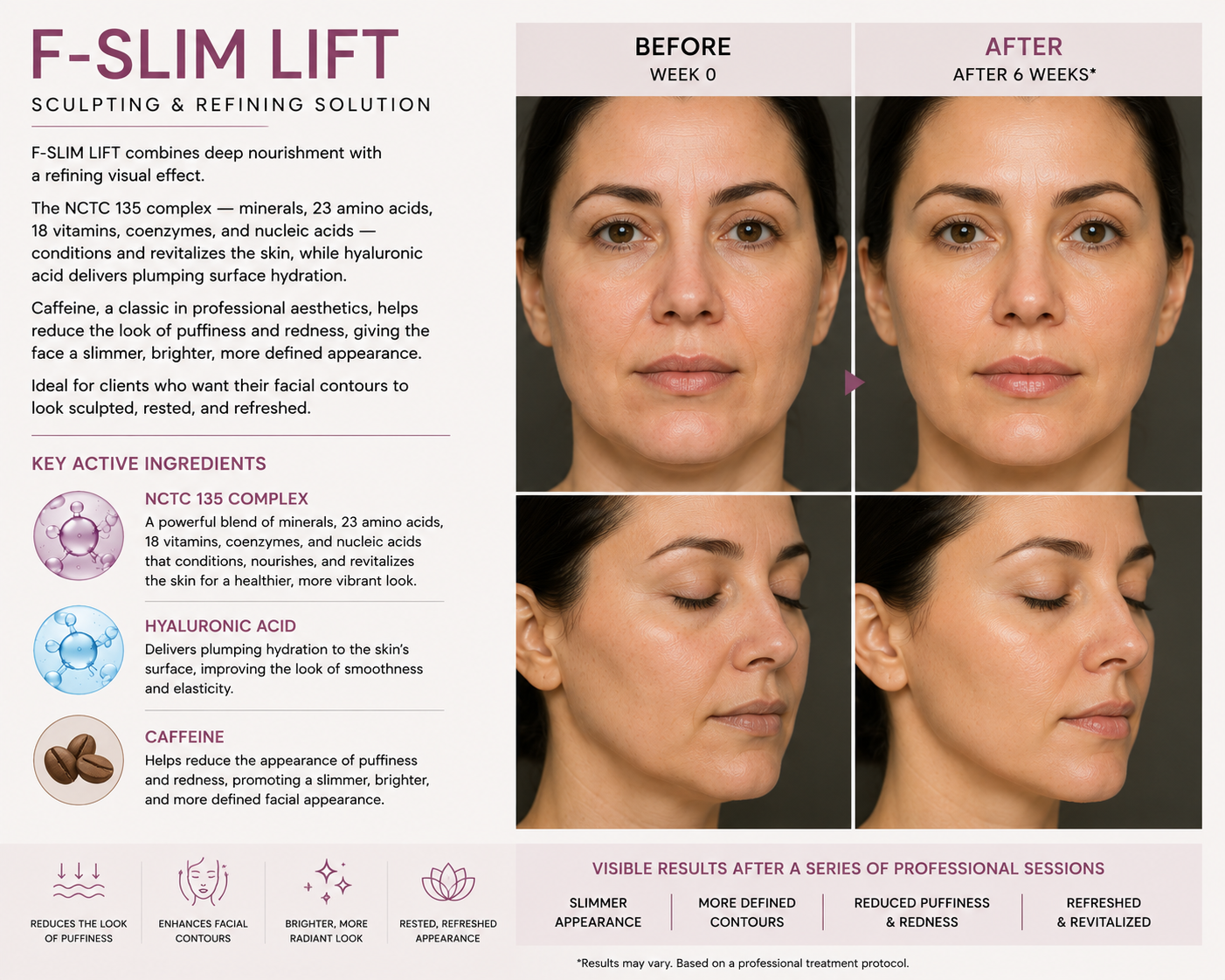 F-SLIM LIFT Sculpting & Revitalizing Facial Solution 5 vials x 10 ml (1.69 fl. oz.)