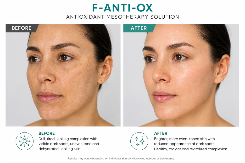 F-ANTI-OX Antioxidant Defense Solution Box of 5 vials x 10 ml / 1.69 fl. oz.