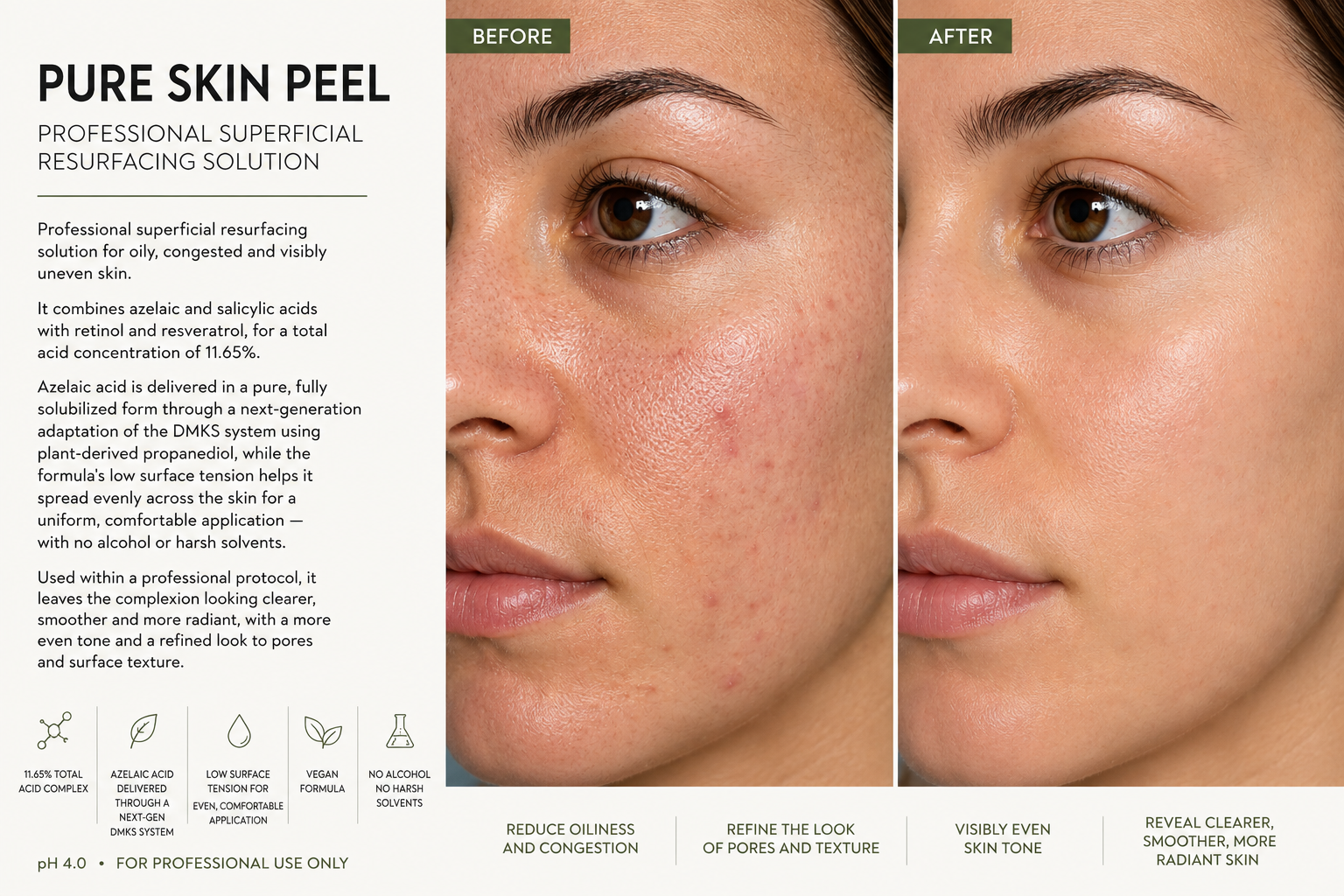 Pure Skin Peel |  70 ml / 2.37 fl.oz   |  Resurfacing peels PRO